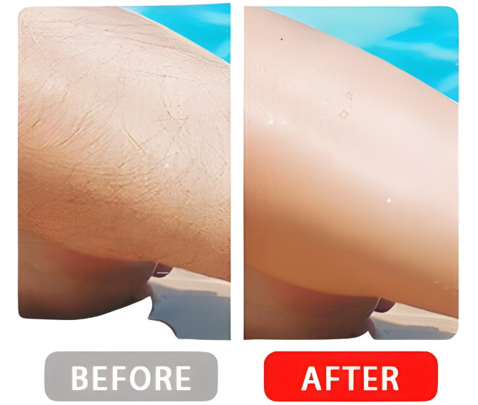 Instant Smooth™ Painless Hair Eraser - 50% OFF SALE Today Only