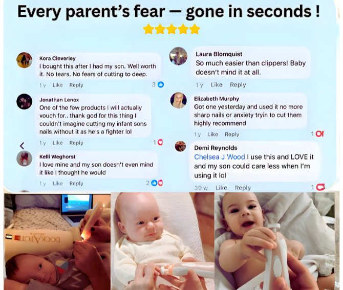 Baby Nail Trimmer Set - 50% OFF SALE Today Only