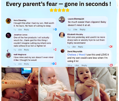 Baby Nail Trimmer Set - 50% OFF SALE Today Only