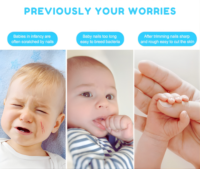 Baby Nail Trimmer Set - 50% OFF SALE Today Only